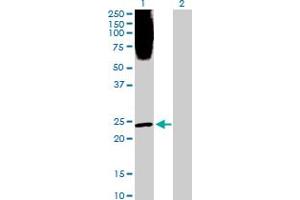 Western Blot analysis of PLA2G1B expression in transfected 293T cell line by PLA2G1B MaxPab polyclonal antibody. (PLA2G1B Antikörper  (AA 1-148))