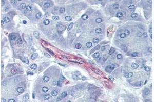 Pancreas, Human: Formalin-Fixed, Paraffin-Embedded (FFPE) (Cadherin 5 Antikörper)