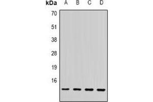 Western blot analysis of SSNA1 expression in PC3 (A), MCF7 (B), mouse spleen (C), rat brain (D) whole cell lysates.