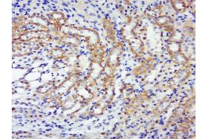 Immunohistochemistry (Paraffin-embedded Sections) (IHC (p)) image for anti-Ribosomal Protein S6 Kinase, 70kDa, Polypeptide 2 (RPS6KB2) (pSer447), (pThr444) antibody (ABIN702850)