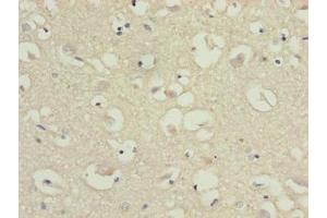 Immunohistochemistry of paraffin-embedded human brain tissue using ABIN7147813 at dilution of 1:100 (CMTM5 Antikörper  (AA 1-35))