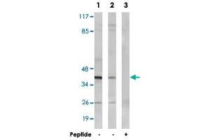 Western blot analysis of extracts from MCF-7 cells (Lane 1 and lane 3) and HepG2 cells (Lane 2), using NT5C1A polyclonal antibody . (NT5C1A Antikörper)