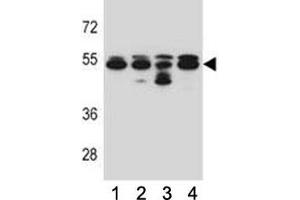 TUBB8 antibody western blot analysis in 293, A549, HepG2, K562 lysate. (Tubulin, beta 8 Antikörper  (AA 34-62))