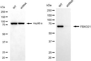 Western blotting analysis using FBXO21 antibody (ABIN7798555).