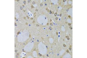 Immunohistochemistry of paraffin-embedded mouse brain using YWHAZ antibody (ABIN5975846) at dilution of 1/100 (40x lens). (14-3-3 zeta Antikörper)