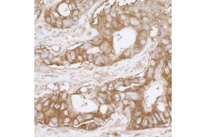 Immunohistochemistry (IHC) image for anti-Major Vault Protein (MVP) (AA 843-893) antibody (ABIN7453922) (MVP Antikörper  (AA 843-893))