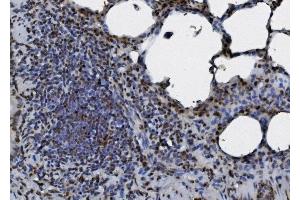 IHC analysis of hnRNP D/AUF1/HNRNPD using anti-hnRNP D/AUF1/HNRNPD antibody (ABIN7602591).