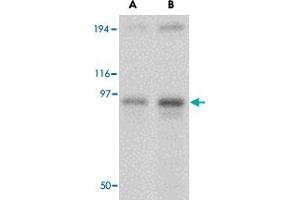 Western blot analysis of NUP107 in A-549 cell lysate with NUP107 polyclonal antibody  at (A) 1 and (B) 2 ug/mL . (NUP107 Antikörper  (Internal Region))