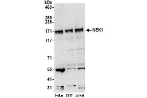 anti-NIMA-Related Kinase 1 (NEK1) (AA 1208-1258) antibody