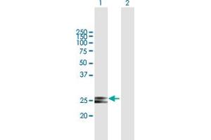 Western Blot analysis of HSCB expression in transfected 293T cell line by HSCB MaxPab polyclonal antibody. (HSCB Antikörper  (AA 1-235))