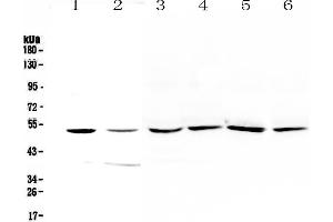 Western blot analysis of HGD using anti-HGD antibody . (HGD Antikörper  (AA 374-445))