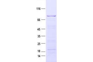Western Blotting (WB) image for MAP/microtubule Affinity-Regulating Kinase 3 (MARK3) protein (His tag) (ABIN2725510)