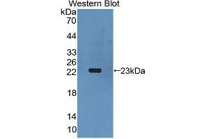 Western Blotting (WB) image for anti-Gremlin 1 (GREM1) antibody (Biotin) (ABIN1175538) (GREM1 Antikörper  (Biotin))