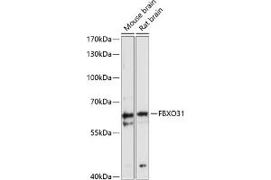 Western blot analysis of extracts of various cell lines, using FBXO31 antibody (ABIN6129682, ABIN6140518, ABIN6140519 and ABIN6216685) at 1:3000 dilution. (FBXO31 Antikörper  (AA 240-539))