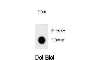 Dot blot analysis of mouse CCNB3 Antibody (Phospho ) Phospho-specific Pab (ABIN1881165 and ABIN2839919) on nitrocellulose membrane. (Cyclin B3 Antikörper  (pSer286))