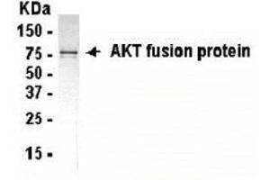 Western Blotting (WB) image for anti-V-Akt Murine Thymoma Viral Oncogene Homolog 1 (AKT1) (AA 2-200) antibody (ABIN2467767) (AKT1 Antikörper  (AA 2-200))