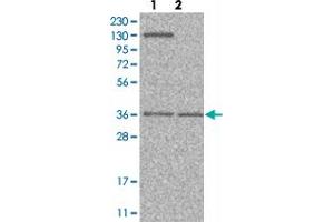 Western blot analysis of Lane 1: Human cell line RT-4 Lane 2: Human cell line U-251MG sp with PVRL1 polyclonal antibody  at 1:100-1:250 dilution. (PVRL1 Antikörper)