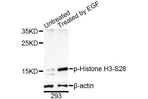 Western blot analysis of extracts of 293T cells, using Phospho-Histone H3-S28 antibody (ABIN5969937) at 1/1000 dilution. (Histone H3.1 Antikörper  (pSer29))