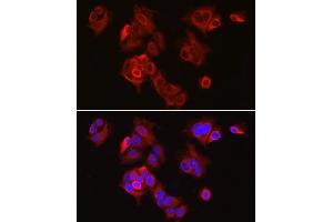 Immunofluorescence analysis of MCF7 cells using SLC7 Rabbit pAb (ABIN3016800, ABIN3016801, ABIN1682793 and ABIN6219842) at dilution of 1:300 (40x lens). (SLC7A5 Antikörper  (AA 1-125))