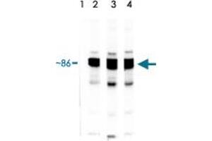 Lane 1 : HSP90 protein standard stressgen. (HSP90 alpha/beta Antikörper)