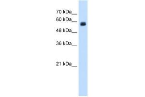 WB Suggested Anti-CLEC4M Antibody Titration:  1. (C-Type Lectin Domain Family 4, Member M (CLEC4M) (N-Term) Antikörper)