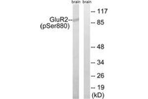 Western blot analysis of extracts from mouse brain, using GluR2 (Phospho-Ser880) Antibody.