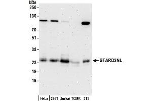 Western Blotting (WB) image for anti-STARD3 N-Terminal Like (STARD3NL) (AA 184-234) antibody (ABIN7450782)