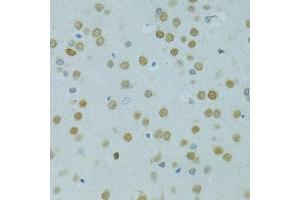 Immunohistochemistry of paraffin-embedded rat brain using MUS81 antibody (ABIN6132372, ABIN6144202, ABIN6144203 and ABIN6222560) at dilution of 1:100 (40x lens). (MUS81 Antikörper  (AA 1-350))