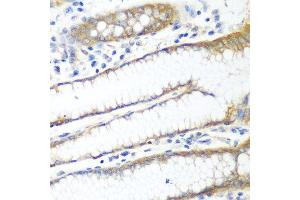 Immunohistochemistry of paraffin-embedded human stomach using PPP4R1 antibody at dilution of 1:100 (40x lens). (PPP4R1 Antikörper)