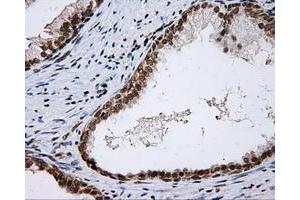 Immunohistochemical staining of paraffin-embedded colon tissue using anti-SHC1 mouse monoclonal antibody. (SHC1 Antikörper)