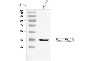 Western blot analysis of RNASEH2B using anti-RNASEH2B antibody (ABIN7601572).