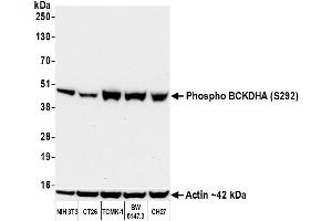 Western Blotting (WB) image for anti-Branched Chain Keto Acid Dehydrogenase E1, alpha Polypeptide (BCKDHA) (pSer292) antibody (ABIN7449282) (Rekombinanter BCKDHA Antikörper  (pSer292))
