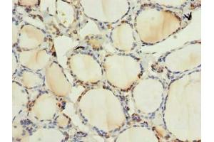 Immunohistochemistry of paraffin-embedded human thyroid tissue using ABIN7165103 at dilution of 1:100 (ARMCX6 Antikörper  (AA 28-300))