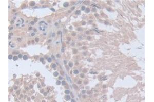Immunohistochemistry (IHC) image for anti-Intersectin 1 (ITSN1) (AA 1-227) antibody (ABIN7444238)
