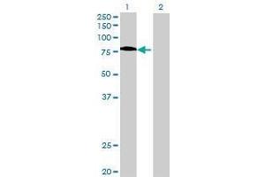 Western Blotting (WB) image for FEM1A 293T Cell Transient Overexpression Lysate(Denatured) (ABIN1336912)