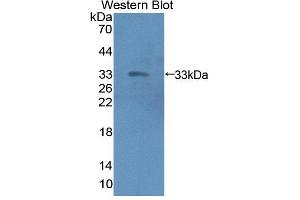 Western blot analysis of the recombinant protein. (Emilin1 Antikörper  (AA 803-1016))