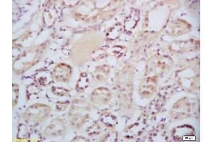 Formalin-fixed and paraffin embedded human kidney labeled with Rabbit Anti-Sclerostin Polyclonal Antibody, Unconjugated (ABIN1714867) at 1:200 followed by conjugation to the secondary antibody and DAB staining (Sclerostin Antikörper  (AA 121-180))