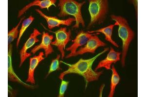 HeLa cells staining with ABIN1580426 (red), and counterstained with ’s chicken polyclonal antibody to Vimentin CPCA-Vim (green) and DNA (blue). (HSP27 Antikörper)