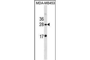 Western blot analysis in MDA-MB453 cell line lysates (35ug/lane). (CLDN14 Antikörper  (C-Term))