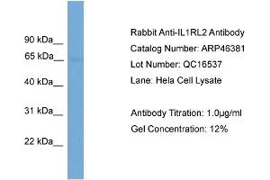 WB Suggested Anti-IL1RL2  Antibody Titration: 0. (IL1RL2 Antikörper  (N-Term))