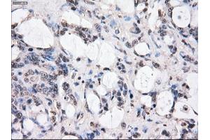 Image no. 2 for anti-Budding Uninhibited By Benzimidazoles 1 Homolog beta (Yeast) (BUB1B) antibody (ABIN1496995) (BUB1B Antikörper)