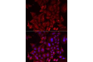 Immunofluorescence analysis of U2OS cell using PANX1 antibody. (PANX1 Antikörper)