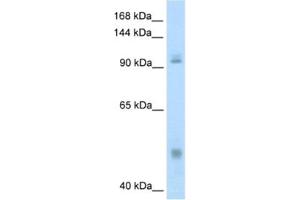 Western Blotting (WB) image for anti-Nuclear Factor of kappa Light Polypeptide Gene Enhancer in B-Cells 1 (NFKB1) antibody (ABIN2461714) (NFKB1 Antikörper)