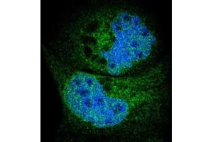 Immunofluorescent staining of A-431 cells with SYVN1 polyclonal antibody  (Green) shows positivity in endoplasmic reticulum and nucleus but excluded from the nucleoli. (SYVN1 Antikörper)