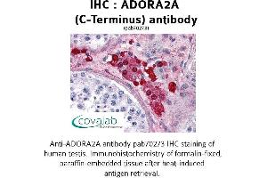 Image no. 1 for anti-Adenosine A2a Receptor (ADORA2A) (C-Term), (Cytoplasmic Domain) antibody (ABIN1731565) (Adenosine A2a Receptor Antikörper  (C-Term, Cytoplasmic Domain))