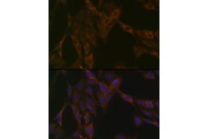 Immunofluorescence analysis of C6 cells using DDX6 Rabbit mAb (ABIN7266703) at dilution of 1:100 (40x lens). (DDX6 Antikörper)
