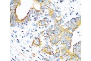 Immunohistochemistry of paraffin-embedded Human stomach using MTCO2 Polyclonal Antibody at dilution of 1:100 (40x lens). (COX2 Antikörper)