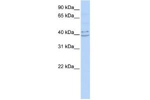 WB Suggested Anti-PYHIN1 Antibody Titration:  0. (PYHIN1 Antikörper  (N-Term))