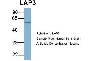 Host: Rabbit  Target Name: LAP3  Sample Tissue: Human Fetal Brain  Antibody Dilution: 1.