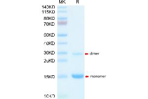 SDS-PAGE (SDS) image for S100 Calcium Binding Protein A9 (S100A9) (AA 2-113) protein (His tag) (ABIN7275544)
